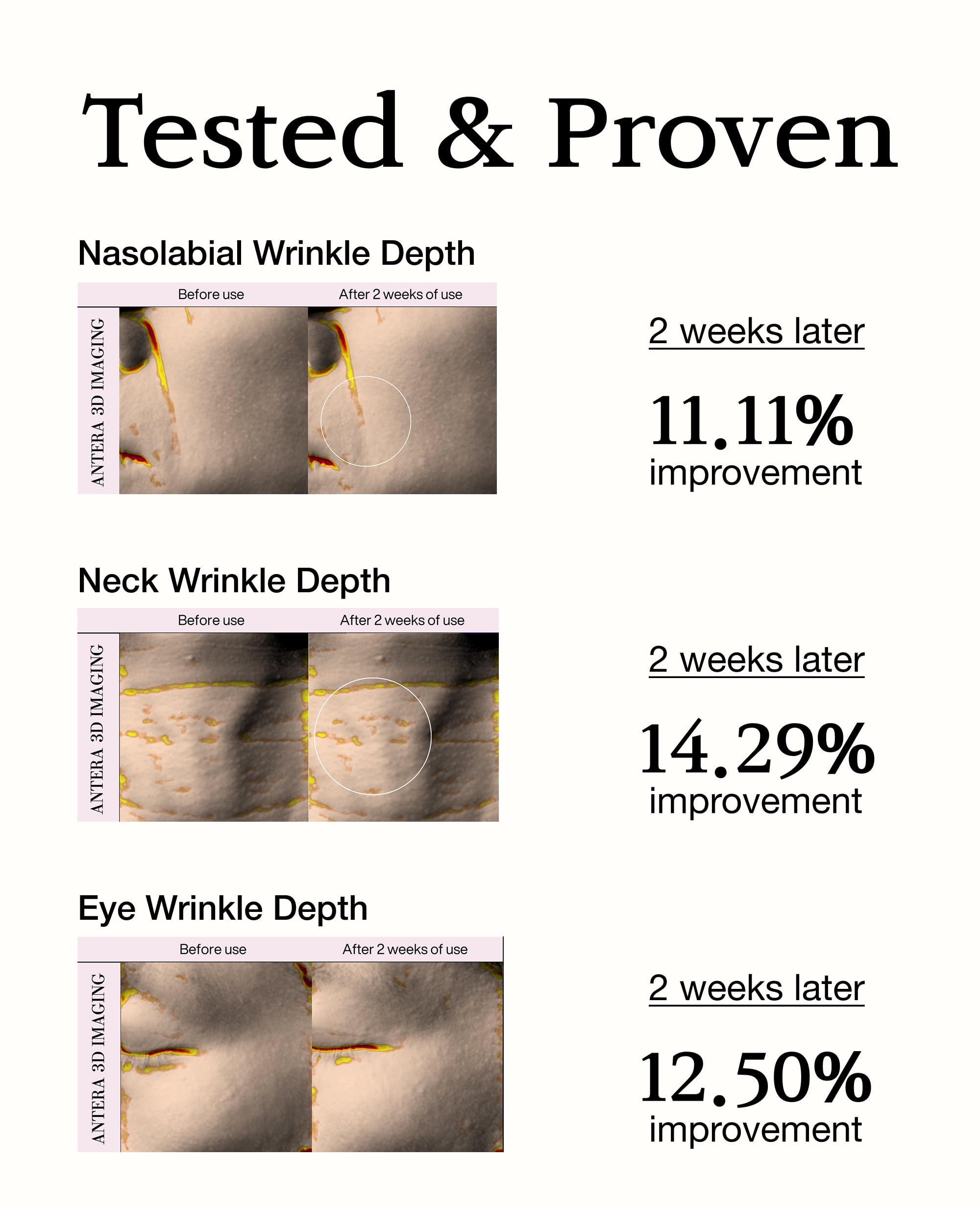 BLANC DUBU Nuborn Cell Honey Retinol Shot Serum Low-Irritation Capsuretinol with Acacia Honey TECA-Biome Anti-Aging Wrinkle Serum for Sensitive Skin 0.51 fl oz