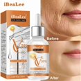thumbnail image 1 of IBeaLee Vitamin C Facial essence Lighten fine lines and remove acne prints, brighten skin tone, moisturize and tighten skin essence, 1 of 5