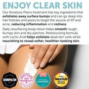 KP Bump Eraser Lotion Keratosis Pilaris Lotion with Glycolic Acid, AHA & BHA Exfoliating Rough & Bumpy Skin Body Lotion