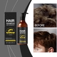 thumbnail image 5 of 100ml Dandruff Shampoo Scalp Oil And Maintains A Refreshing Scalp, 5 of 8