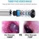 thumbnail image 3 of 1 Pack Ear Wax Removal, Ear Cleaner, Otoscope, Earwax Remover Tools, Scope, With 1080p Fhd Camera, 6 Led Lights, Wireless Connected, Compatible With I, 3 of 5