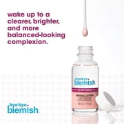 Bye Bye Blemish Acne Drying Lotion with Salicylic Acid for Pimple Care, 1 fl oz
