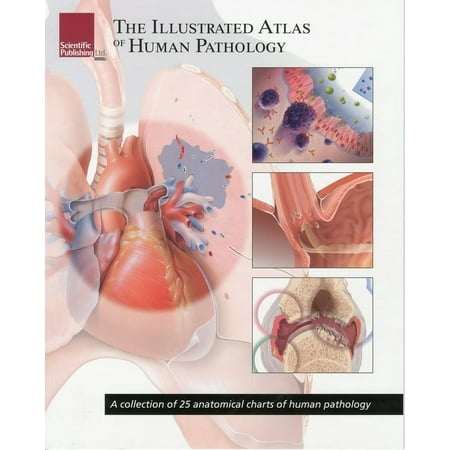 UPC: 9781932922998 | The Illustrated Atlas of Human Pathology (Paperback)