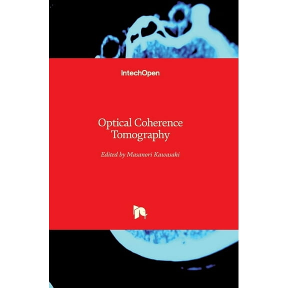 Optical Coherence Tomography (Hardcover)