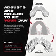 SAFEJAWZ Sports Mouth Guard with Case, Dual Layer Adult and Youth Mouthguard (Black Fangz, Adult (12+ Years))