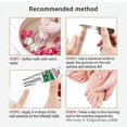 thumbnail image 5 of Ibealee Nail Fungus Treatment Essence Serum Fungal Removal Repair Gel Anti-infective Paronychia Onychomycosis, 5 of 5