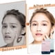 thumbnail image 5 of Facial Acne Patch Hydrocolloid Acne Patch With Tea Oil Witch Hazel Centella Asiatica And Hyaluronic, 5 of 5