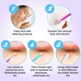 thumbnail image 2 of Graflsoa 10-Piece Stainless Steel Blackhead Removal Kit with Gradient Blue-Purple Case, 2 of 5