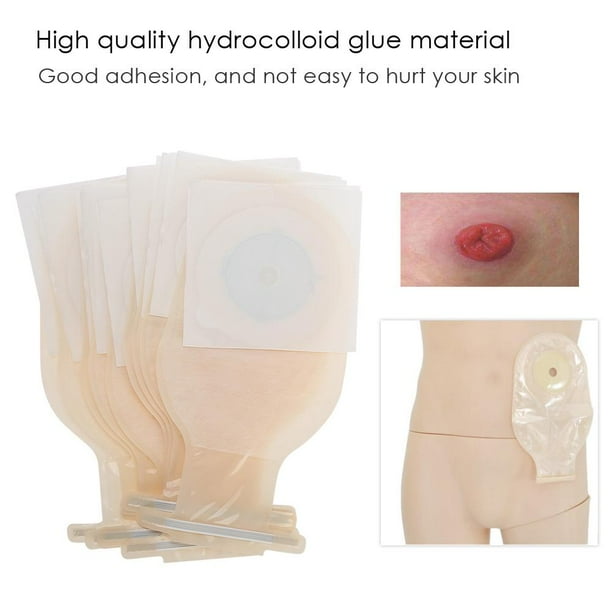 Tebru 10pcs/Pack Onepiece System Ostomy Bag Medicals