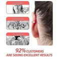 thumbnail image 2 of 2/4/6/8pcs Ear Correctar Tape Ear Correctar Fixer Cosmetic Ear Stickers, 2 of 5