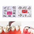 thumbnail image 2 of 100 st Dental Pro Metal Matrix Bands Sectional Contoured Band R A1, 2 of 5