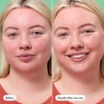 thumbnail image 4 of Hero Cosmetics Rescue Balm +Red Correct, Post-Blemish Color-Correcting Cream, 15ml, 4 of 8