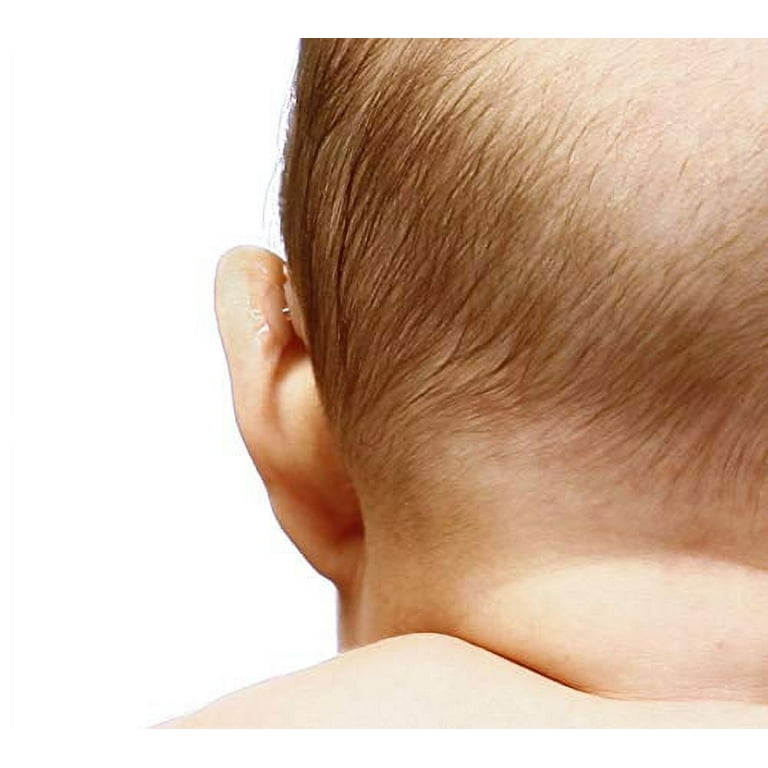 otostick - Are you concerned that your baby's ear stick out too much? 👂👂  Then, try Otostick Baby, it PERMANENTLY reduces the angle of protruding  ears with regular use of 12 months!
