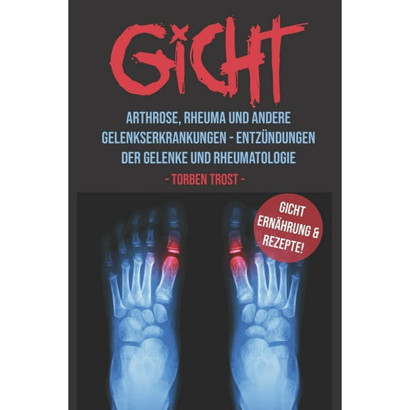 Gicht Arthrose, Rheuma, Und Andere Gelenkserkrankungen - Entzündungen Der Gelenke Und Rheumatologie Gicht Ernährung Und Rezepte (Paperback)