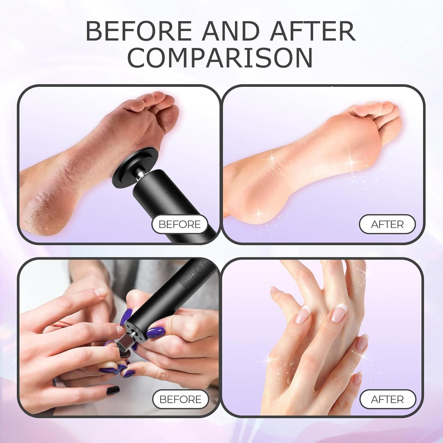 Aorsher Electronic Foot File Grinder with 60pcs Replacement Sandpaper Discs, Adjustable Speed Electric Callus Remover Professional Pedicure Tool for Men Women Dead Cracked Hard Skin Calluses