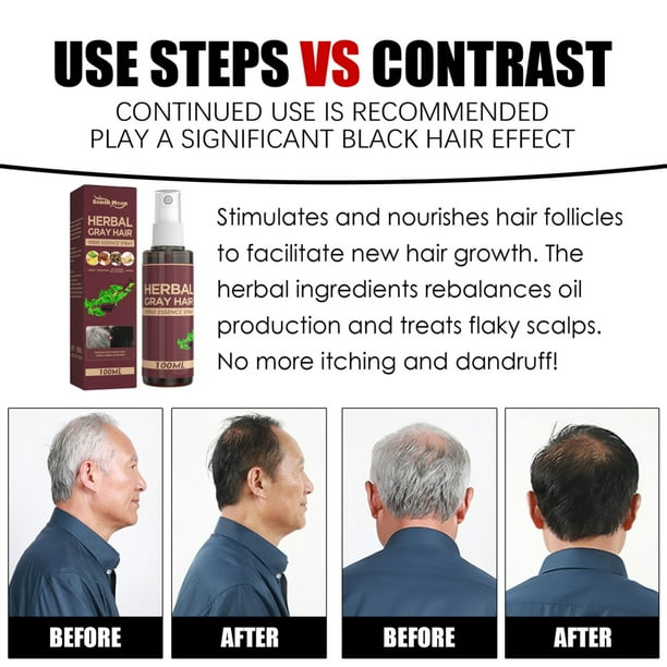 Herbal Grey Hair Spray Quick Effect Gentle Natural Herbal Remove Grey Hair Herbal Grey Hair Spray Quick Effect Gentle Natural Herbal Remove Grey Hair