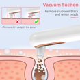 thumbnail image 4 of OUSITAID Blackhead Remover Vacuum 450mAh Rechargeable Facial Pore Cleanser Handheld Blackhead Acne Extractor Tool, 4 of 9