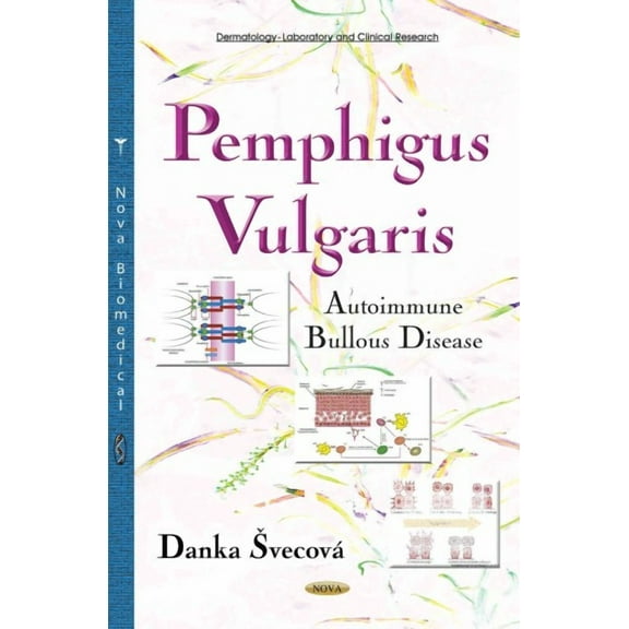 Pemphigus Vulgaris : Autoimmune Bullous Disease