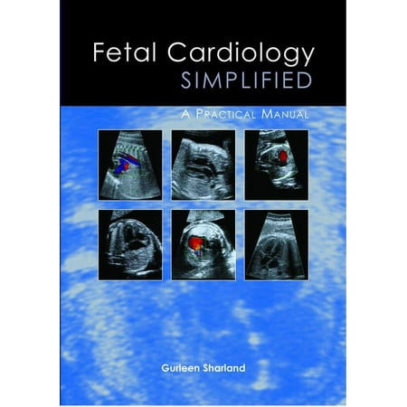 UPC: 9781903378557 | Fetal Cardiology Simplified : A Practical Manual