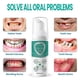 thumbnail image 5 of 1-3pcs Jorondy Teeth Mouthwash,30ml Herbal Brightening Oral Repair Foam Deeply Cleaning, 5 of 5