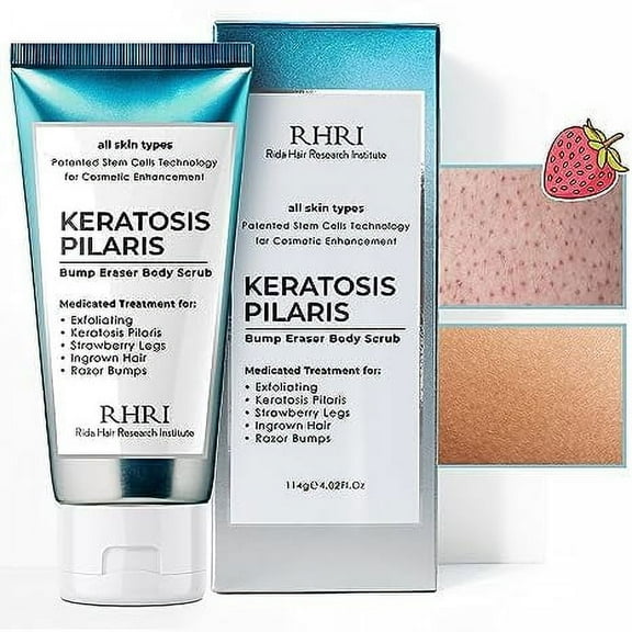 KP Bump Eraser Body Scrub, Keratosis Pilaris Treatment, Strawberry Legs Treatment for Women, Bump Eraser Body Scrub
