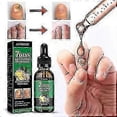 thumbnail image 4 of Jaysuing Ginger Nail Care Solution 30ml Nail Fungus Repair Hand, Foot Nail Care Soft Nail Bright, 4 of 5