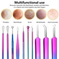 thumbnail image 3 of 10 Pcs Outil de Retrait de Blackhead Popper Outil Kit Outil d'Extraction de Blackhead pour le Visage Outils d'Extraction en Acier Inoxydable (Coloré), 3 of 10