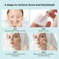 thumbnail image 6 of Pimple Extractor Tools,Blackhead Remover,Pimple Popper,Acne Removal Kit Risk Free Treatment,Whitehead Popping,Blackhead Tweezers, 6 of 9