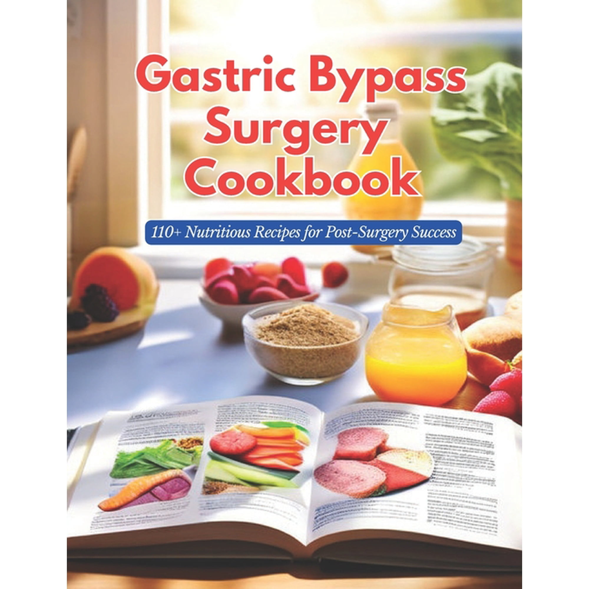 Gastric Bypass Surgery Cookbook: 110+ Nutritious Recipes for Post-Surgery Success, (Paperback)