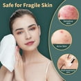 thumbnail image 4 of Toallas faciales desechables Ourmed Life Clean, 4 of 7