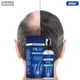 thumbnail image 4 of Solución para el cuidado de la piel Essences para uso externo, 60 ml/spray, detiene la caída del cabello en los hombres, acelera el crecimiento del cabello de forma natural, reacti Autorización, 4 of 8