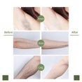 thumbnail image 5 of Lucky Berry Double Sided Wax Strips - Hair Removal Kit for Body, Arms, Legs, Chest & Back, Gentle & Effective Ready-To-Use Strips for Smooth Skin On-The-Go, 5 of 5