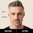 thumbnail image 3 of Corrector en barra Stryx para hombre, tamaño mediano, color caoba, 3 of 5