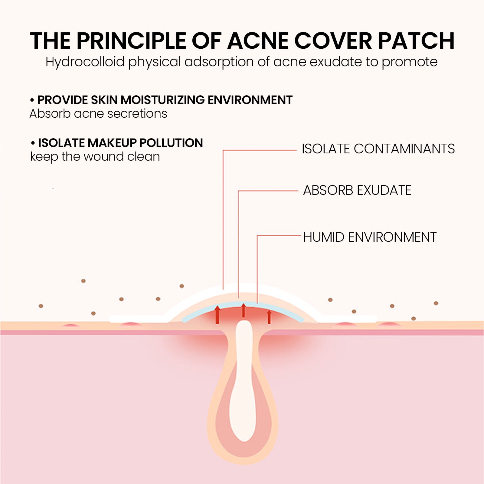 Alvantor Pimple Patches with Tea Tree Hydrocolloid Acne, Star Zit Covers, 200 Count