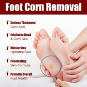 Tkrady Foot Corn Removal Extra Strengthen Gel, Liquid Corn and Callus Remover, Corn Remover Gel for Feet, Corn Removers for Toes Extra Strength 10ml
