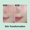 thumbnail image 5 of Cica blanca iluminadora Essence MEDI-PEEL Peptide 9 volúmenes, 5 of 5