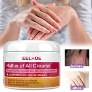 30g Eczema Cream Safe Reliable High Effective Pink Moisturizing Discomfor Relief Eczema Treatment Cream for Women Men