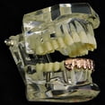 thumbnail image 3 of 14k Rose Gold Plated Nugget Grillz Bottom Slugs Lower Teeth 6 Piece Grill Hip Hop Mouth Grills, 3 of 6