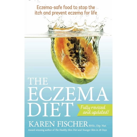 Eczema Diet: Eczema-Safe Food to Stop the Itch and Prevent Eczema for Life, (Paperback)