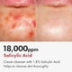 thumbnail image 3 of Limpiador en espuma con ácido salicílico TOSOWOONG, 100 ml, para piel grasa, 3 of 7