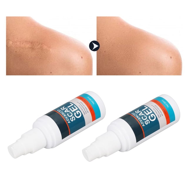 Crema Para Cicatrices, Gel Reparador De Cicatrices Y Sin Grasa, 50 Ml, Calmante Para Estrías Y Arrugas