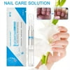 Shutuo Nail Care Solution Toenail Fungus