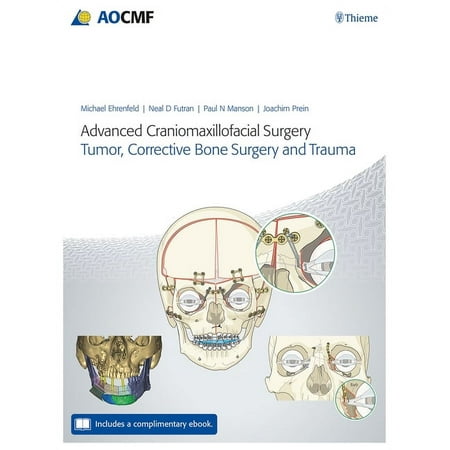 UPC: 9783132428393 | Advanced Craniomaxillofacial Surgery: Tumor  Corrective Bone Surgery  and Trauma (Hardcover)