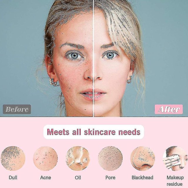 Cepillo de limpieza facial con vibración sónica con 3 cabezales LingWen 8390614100862