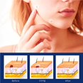 thumbnail image 3 of Soidarity Pack of 108 Simple Patch Workmanship Safety Conceal Removal Patches Operation Skins Removing Tool Unisex Care Type1 NO1 Soidarity CE001964-00, 3 of 6