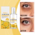 thumbnail image 1 of Crema de ojos con vitamina C 30 g para ojeras - Tratamiento iluminador e hidratante debajo de los ojos con fórmula ligera - Cuidado de ojos antienvejecimiento para líneas finas e hinchazón - Suave, 1 of 7