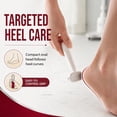 thumbnail image 5 of Double-Sided Foot Scraper for Callus Removal, Stainless Steel Foot File Tool, Arc-Shaped Dead Skin Remover for Rough Feet, Cracked Heels & Pedicure Care, White+2*filer, 5 of 9