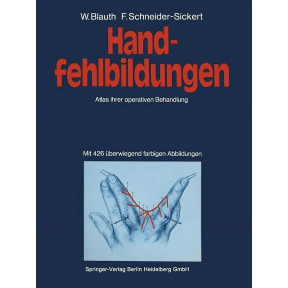 Handfehlbildungen: Atlas Ihrer Operativen Behandlung, (Paperback)