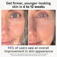 thumbnail image 2 of iRestore Red Light Therapy for Face - Anti Aging LED Face Mask for Youthful Radiant Skin with Reduced Wrinkles, Fine Lines - Red, Blue & Infrared Therapy Mask - Facial Skincare Device with 360 LEDs, 2 of 9