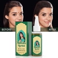 thumbnail image 4 of Hogar y cocina, Productos de cocina, Para la cocina, Menaje de cocina, Aceite capilar a base de hierbas Oil India, pérdida del cabello, crecimiento rápido, espesamiento, 50 ml, The Pendant, 4 of 9